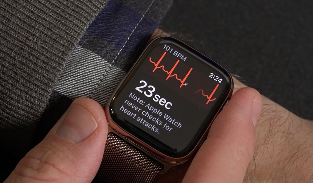 Photo d'une montre Apple Watch avec l'application EGG pour la santé cardiaque